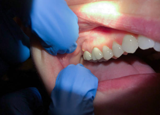 Best Emergency Gum Pain Relief  in Oshkosh, WI