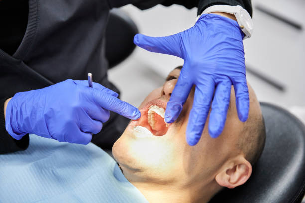 Best Chipped Tooth Repair Near Me  in Oshkosh, WI